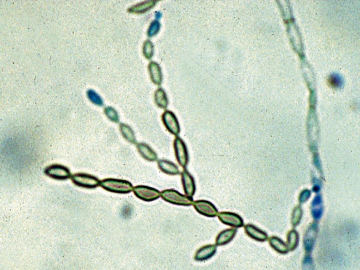 Fungo mortal que ‘derrete’ o cérebro se espalha, e cientistas nos EUA não sabem o porquê