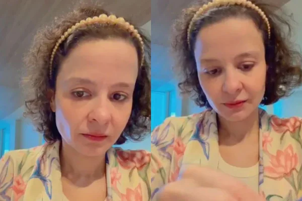 Luta de Maiara contra alopecia reacende debate sobre transplante capilar