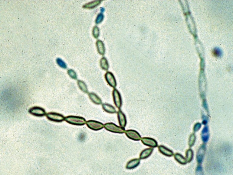 Fungo mortal que ‘derrete’ o cérebro se espalha, e cientistas nos EUA não sabem o porquê